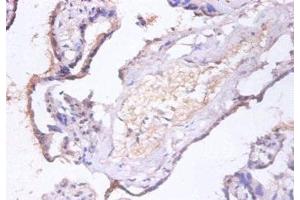 Immunohistochemistry of paraffin-embedded human placenta tissue using ABIN7147519 at dilution of 1:100 (CHMP2A anticorps  (AA 1-222))