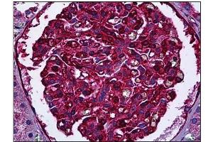 Immunohistochemistry (IHC) image for anti-Myosin 9 (MYH9) antibody (ABIN782310)