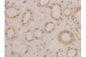 DAB staining on IHC-P; Samples: Human Kidney Tissue (BLMH anticorps  (AA 213-447))