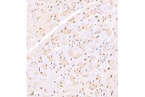 Immunohistochemistry of paraffin embedded mouse heart using TFIIIC110 (ABIN7074038) at dilution of 1:2500 (400x lens)