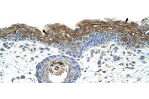 Immunohistochemical staining (Formalin-fixed paraffin-embedded sections) of human skin with EIF2A polyclonal antibody  at 4-8 ug/mL working concentration. (EIF2A anticorps  (C-Term))