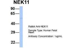 Host:  Rabbit  Target Name:  NEK11  Sample Type:  Human Fetal Heart  Antibody Dilution:  1. (NEK11 anticorps  (Middle Region))