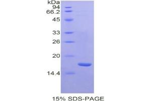 SDS-PAGE of Protein Standard from the Kit  (Highly purified E.