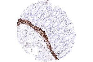 Rectum Strong desmin staining of lamina muscularis mucosae