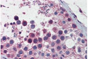 anti-Structural Maintenance of Chromosomes 3 (SMC3) (AA 1051-1100) antibody