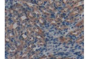 Detection of GSTt1 in Mouse Kidney Tissue using Polyclonal Antibody to Glutathione S Transferase Theta 1 (GSTt1)