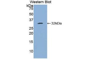Western Blotting (WB) image for anti-B-Cell CLL/lymphoma 3 (BCL3) (AA 82-341) antibody (ABIN1858126) (BCL3 anticorps  (AA 82-341))