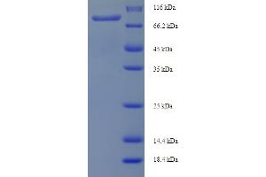 SDS-PAGE (SDS) image for Phospholipase C, delta 4 (PLCD4) (AA 1-762), (full length) protein (His-SUMO Tag) (ABIN5711801)