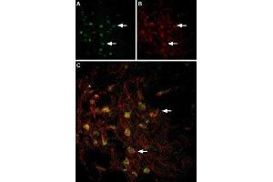 Multiplex staining of VMAT2 and TRPC3 in rat brain - Immunohistochemical staining of perfusion-fixed frozen rat substantia nigra sections using Anti-VMAT2-ATTO Fluor-488 Antibody (ABIN7043689), (1:60) and Anti-TRPC3-ATTO Fluor-594 Antibody (ABIN7043819), (1:60). (TRPC3 anticorps  (C-Term, Intracellular) (Atto 594))