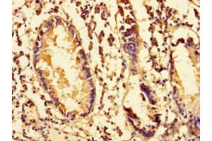 Immunohistochemistry of paraffin-embedded human appendix tissue using ABIN7142262 at dilution of 1:100