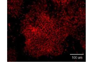 Immunofluorescence analysis of paraformaldehyde-fixed human embryonic stem cell, using OCT3/4 antibody at 1:100 dilution. (OCT4 anticorps)