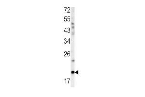 Western blot analysis of GCG antibody (N-term) (ABIN390411 and ABIN2840800) in mouse bladder tissue lysates (35 μg/lane).