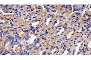 Detection of DDX58 in Mouse Stomach Tissue using Polyclonal Antibody to Probable ATP-dependent RNA Helicase DDX58 (DDX58) (DDX58 anticorps  (AA 1-211))