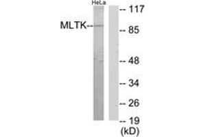 Western blot analysis of extracts from HeLa cells, using MLTK Antibody. (ZAK anticorps  (AA 701-750))