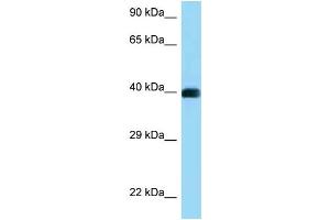 WB Suggested Anti-CD72 Antibody Titration: 1. (CD72 anticorps  (C-Term))