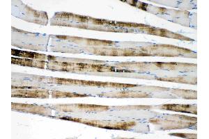IHC analysis of ACTN3/Alpha Actinin 3 using anti- ACTN3/Alpha Actinin 3 antibody .