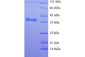 SDS-PAGE (SDS) image for Nerve Growth Factor Receptor (TNFRSF16) Associated Protein 1 (NGFRAP1) (AA 1-111), (full length) protein (GST tag) (ABIN5710009)