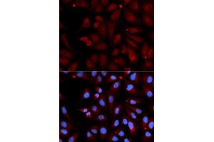 Immunofluorescence analysis of U2OS cells using MAOB antibody (ABIN5970749). (Monoamine Oxidase B anticorps)