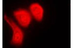 Immunofluorescent analysis of hnRNP K (pS284) staining in Raw264. (HNRNPK anticorps  (pSer284))