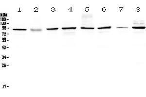 Western blot analysis of SAE2/UBA2 using anti-SAE2/UBA2 antibody . (UBA2 anticorps  (AA 449-564))