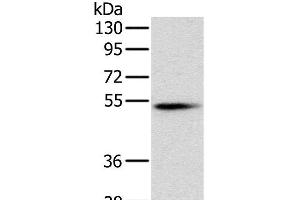 Western Blot analysis of Mouse pancreas tissue using PNLIP Polyclonal Antibody at dilution of 1:400