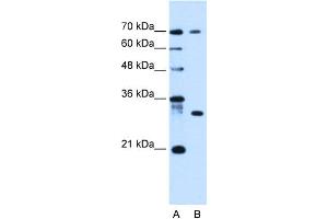 WB Suggested Anti-ATP6AP1L Antibody Titration:  0. (ATP6AP1L anticorps  (C-Term))