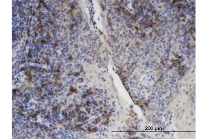 Immunoperoxidase of monoclonal antibody to PLIN3 on formalin-fixed paraffin-embedded human tonsil.