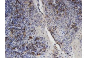 Immunoperoxidase of monoclonal antibody to PLIN3 on formalin-fixed paraffin-embedded human tonsil. (PLIN3 anticorps  (AA 1-434))
