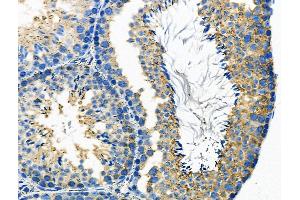 ABIN6264395 and ABIN6276477 at 1/100 staining Mouse testis tissue by IHC-P.