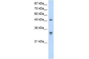WB Suggested Anti-DDX19B Antibody Titration:  2. (DDX19B anticorps  (C-Term))