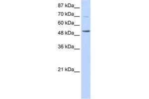 Western Blotting (WB) image for anti-IKAROS Family Zinc Finger 3 (Aiolos) (IKZF3) antibody (ABIN2461838) (IKZF3 anticorps)