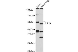 Western blot analysis of extracts of various cell lines, using (ABIN3023366, ABIN3023367, ABIN3023368 and ABIN6219659) at 1:1000 dilution. (IRF2 anticorps  (AA 120-349))