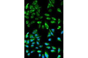 Immunofluorescence analysis of HeLa cell using TRAF6 antibody. (TRAF6 anticorps)