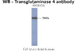 Image no. 1 for anti-Transglutaminase 4 (Prostate) (TGM4) antibody (ABIN347024)