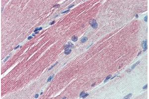 Human Skeletal Muscle: Formalin-Fixed, Paraffin-Embedded (FFPE) (IGFBP6 anticorps  (AA 128-141))
