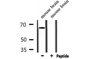 Western blot analysis of extracts from mouse brain, using STXBP1 Antibody. (STXBP1 anticorps  (C-Term))