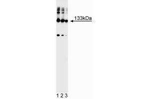 Western blot analysis of mGluR1alpha. (mGluR1 alpha anticorps)