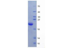 SDS-PAGE analysis of Human Hemojuvelin Protein. (HFE2 Protéine)