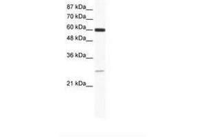Image no. 1 for anti-ZFP91 Zinc Finger Protein (ZFP91) (AA 96-145) antibody (ABIN6736013) (ZFP91 anticorps  (AA 96-145))