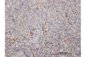 Immunoperoxidase of monoclonal antibody to SOX9 on formalin-fixed paraffin-embedded human pancreas.
