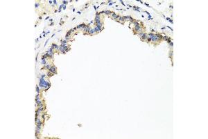 Immunohistochemistry of paraffin-embedded rat lung using CXCR4 antibody (ABIN6292854) at dilution of 1:100 (40x lens). (CXCR4 anticorps)