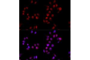 Immunofluorescence analysis of HeLa cells using HMGB1 antibody. (HMGB1 anticorps  (AA 100-200))