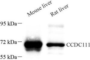 Western blot analysis of CCDC111 (ABIN7073534) at dilution of 1: 500 (CCDC111 anticorps)