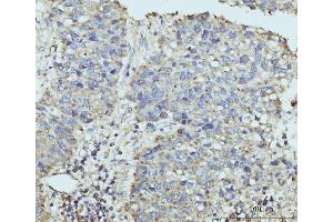 IHC analysis of HUPF2/RENT2/UPF2 using anti-HUPF2/RENT2/UPF2 antibody (ABIN7600567). (RENT2/UPF2 anticorps  (AA 200-651))