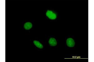 Immunofluorescence of purified MaxPab antibody to ZNF509 on HeLa cell. (ZBTB49 anticorps  (AA 1-248))