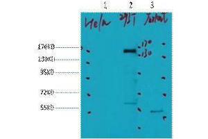 Western Blotting (WB) image for anti-Receptor tyrosine-protein kinase erbB-2 (ErbB2/Her2) antibody (ABIN3181149) (ErbB2/Her2 anticorps)