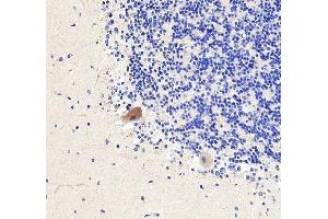 IHC analysis of RHOT1 using anti-RHOT1 antibody (ABIN7602209).