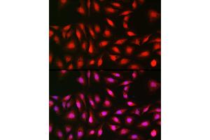 Immunofluorescence analysis of U-2 OS cells using p70 S6 Kinase 1 1 Rabbit pAb (ABIN3023168, ABIN3023169, ABIN3023170, ABIN1513490 and ABIN6219422) at dilution of 1:100 (40x lens).