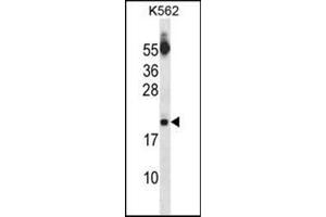 Western blot analysis of SAP18 Antibody (Center) Cat. (SAP18 anticorps  (Middle Region))