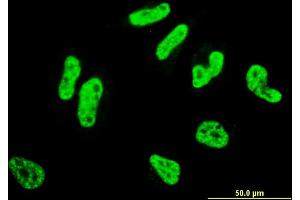 Immunofluorescence of monoclonal antibody to RCSD1 on HeLa cell. (RCSD1 anticorps  (AA 181-289))